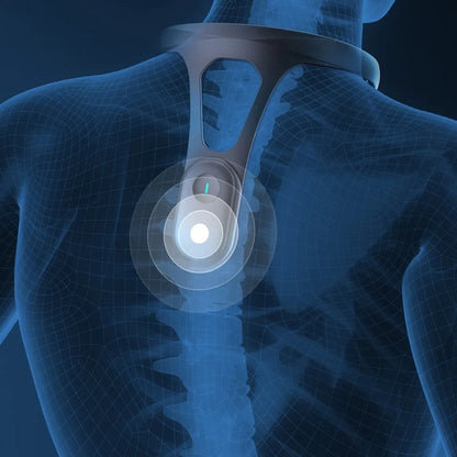 ErgoAlign Smart Posture Corrector